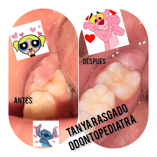 Consultorio dental infantil (odontopediatra) Dra. Tanya Libertad Rasgado - Thumbnail