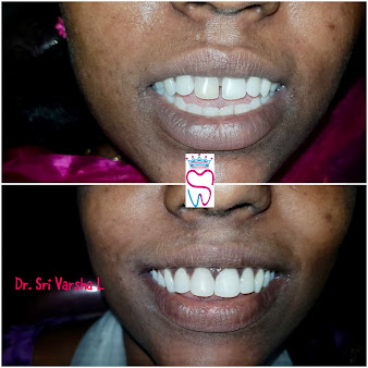 Af1qipon5s5swyl4ln70r34eeznuzx35aqhdpmdrzknd=s338 K No