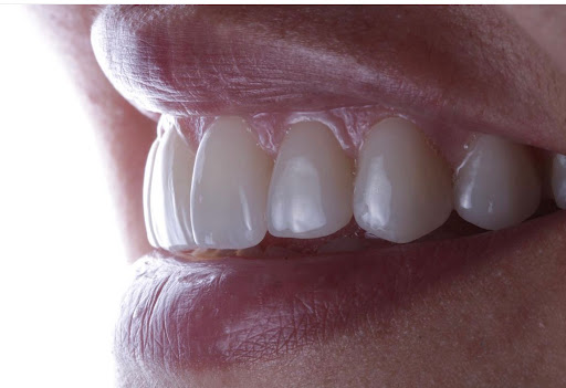 DONE DENTAL - Visual
