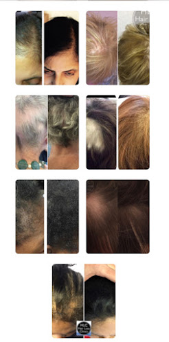 Comments and reviews of Leicester Hair Loss Clinic