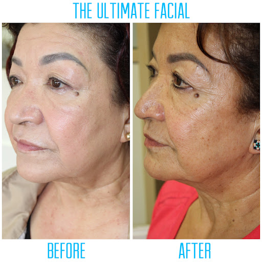 The Ultimate Facial