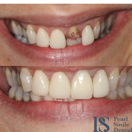 Comments and reviews of Pearl Smile Dentist Oldham