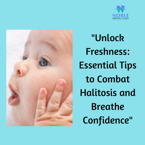 Are you struggling with bad breath? Don't worry, you're not alone! Bad breath, also known as hali… post image
