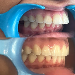 Photo n°4 de Dr Sarah Benazra Orthodontie enfants et adultes Invisalign 75 - 91 à Paris (Dentiste)