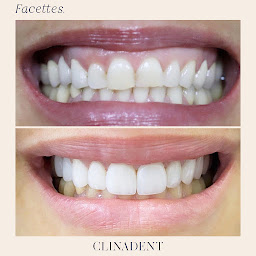 Photo n°24 de Clinadent - Centre de Santé Dentaire Marseille 8, Prado-Périer à Marseille (Orthodontiste)