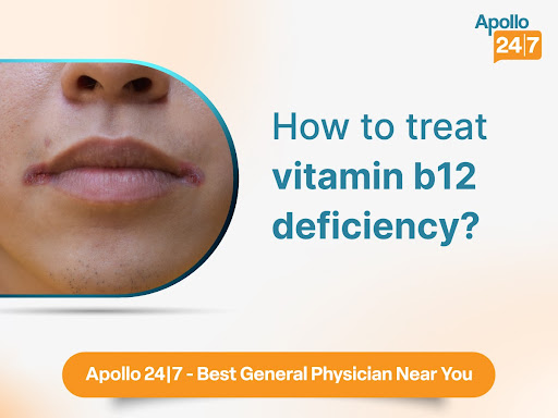 Hypovitaminosis B12 is a condition characterized by a deficiency of vitamin B12 in the body. Vita…