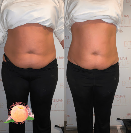 Body Contour Club North West - Thumbnail