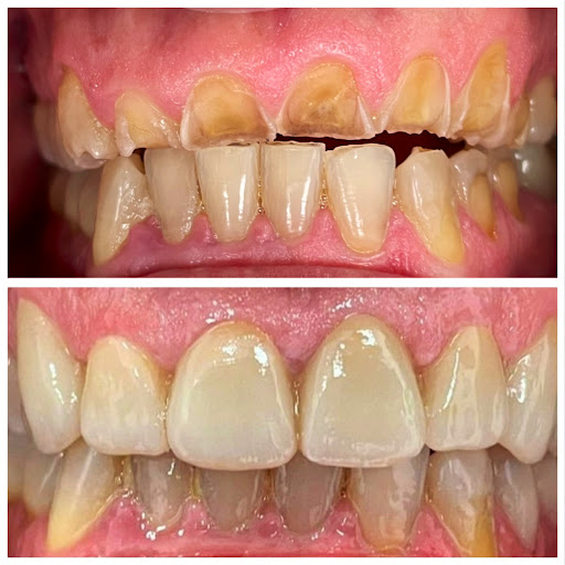 Studio Dentistico Dr. Erra - Thumbnail