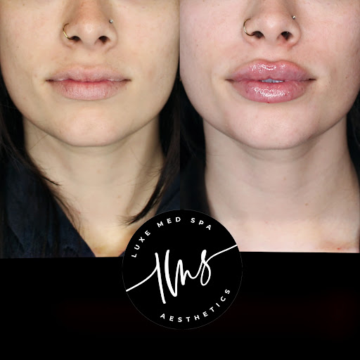 LUXE Med Spa Aesthetics