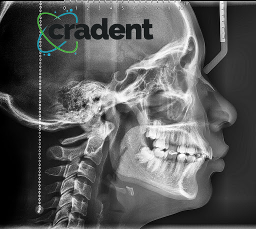 Cradent - Thumbnail