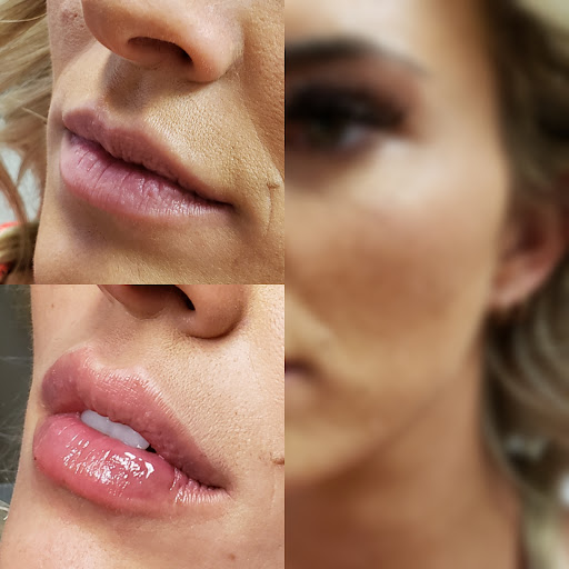 Viso Bespoke Aesthetics