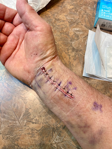 Hand Microsurgery - Visual