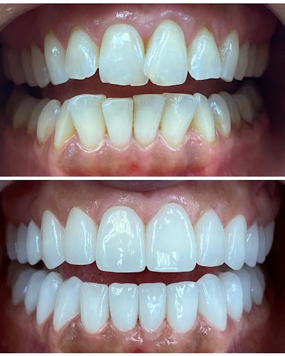Choosing the right dental care provider is essential for maintaining a healthy and confident smil…