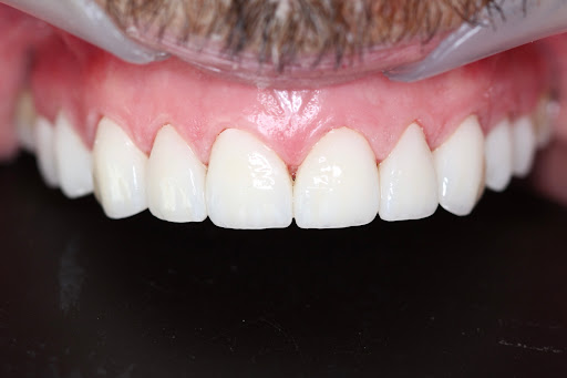Dr. Cristian Palacios Periodoncia e implantes - Thumbnail