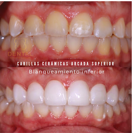 Dentista Cancún HG Odontología Integral