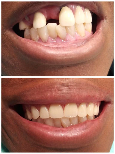 Bhullar Rajinder DDS Gallery - United States