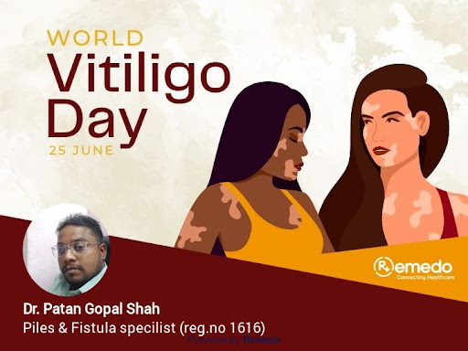 World Vitiligo Day, observed on June 25th, is a global event dedicated to raising awareness about… post image