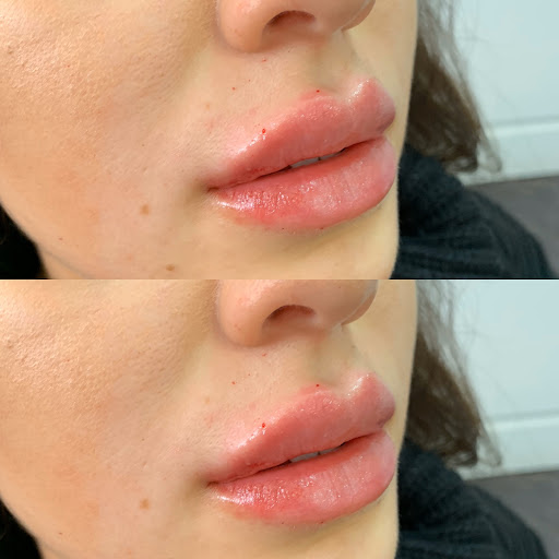 Klinik Refine - Thumbnail