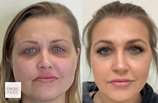 Fresh Face Aesthetics