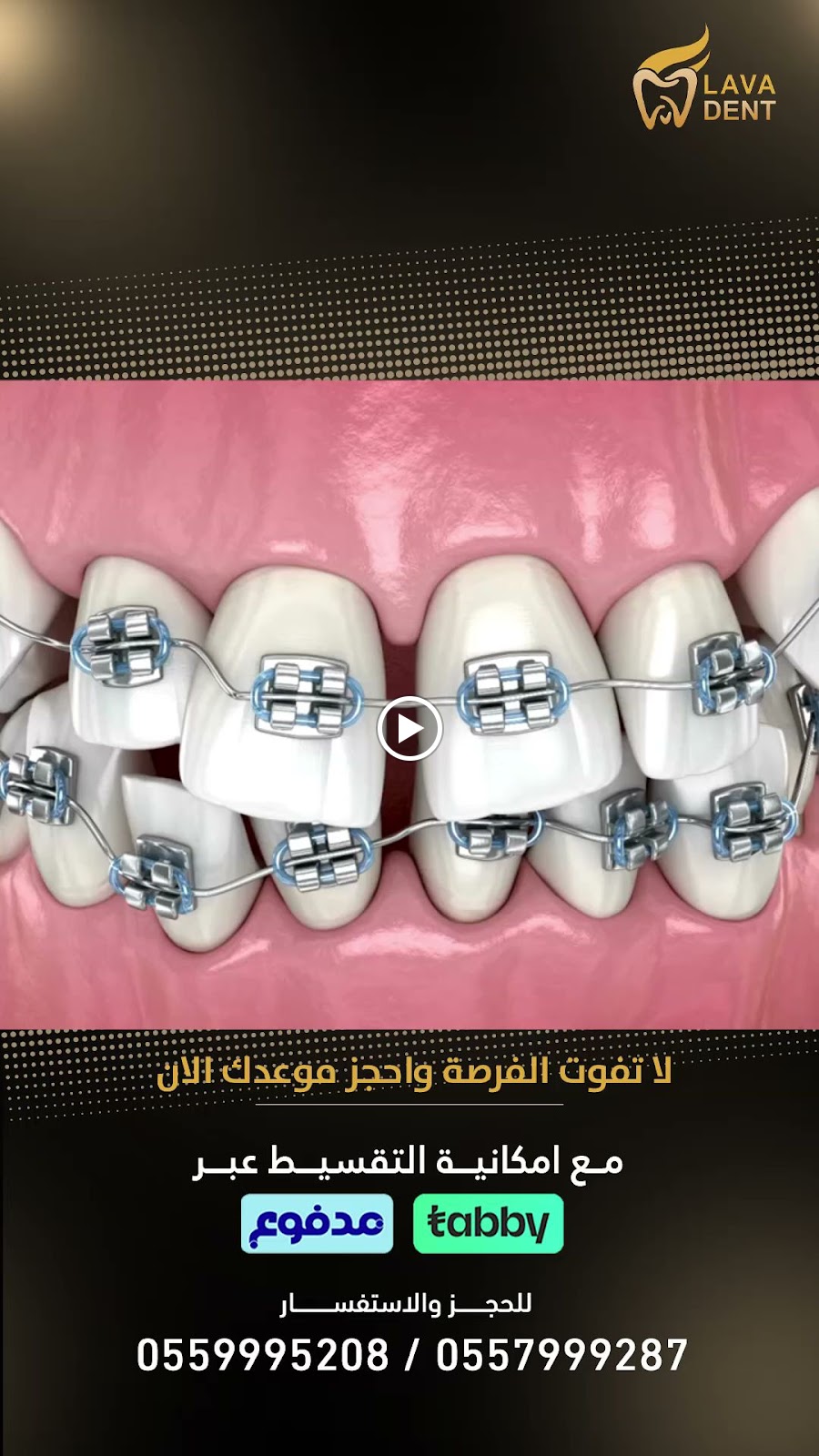 لافا دينت لطب الأسنان - صورة 3