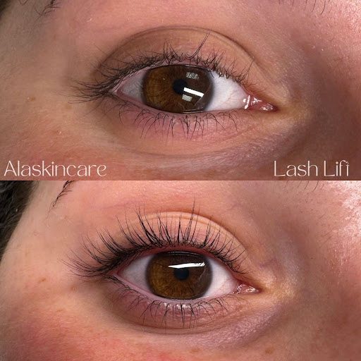 Alaskincare Spa - Thumbnail