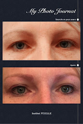 Photo n°19 de PIXELLE à Mâcon (Clinique de maquillage permanent)