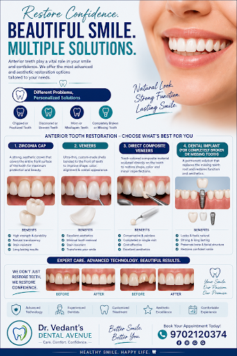 Anterior tooth solutions to problems post image