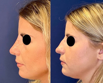 Rhinoplastie Bordeaux Dr Renard