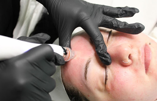 Affinity Beauty Clinic - Thumbnail