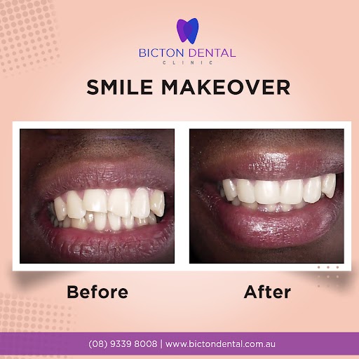 Bicton Dental
