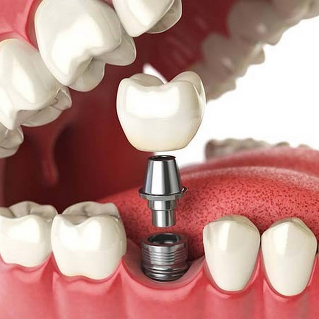 Diamond Dental Dentist in Minneapolis