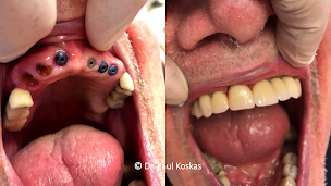 Photo n°10 de Dentiste Argenteuil : Dr. Paul Koskas à Argenteuil (Hygiéniste dentaire)