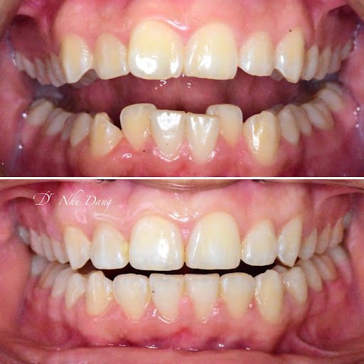 Bella Dental Dallas