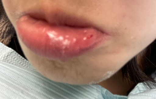 RenovaSmiles - Thumbnail