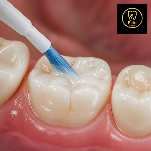 Protect your smile before problems start. At Elite dental clinic in Guru Nanak Colony, Vijayawada… post image