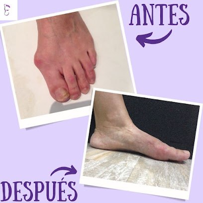 Clínica PodiaFys - Podólogo Málaga