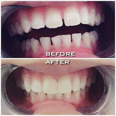 Photos of drg. Sungging Pertiwi - TEA Dental