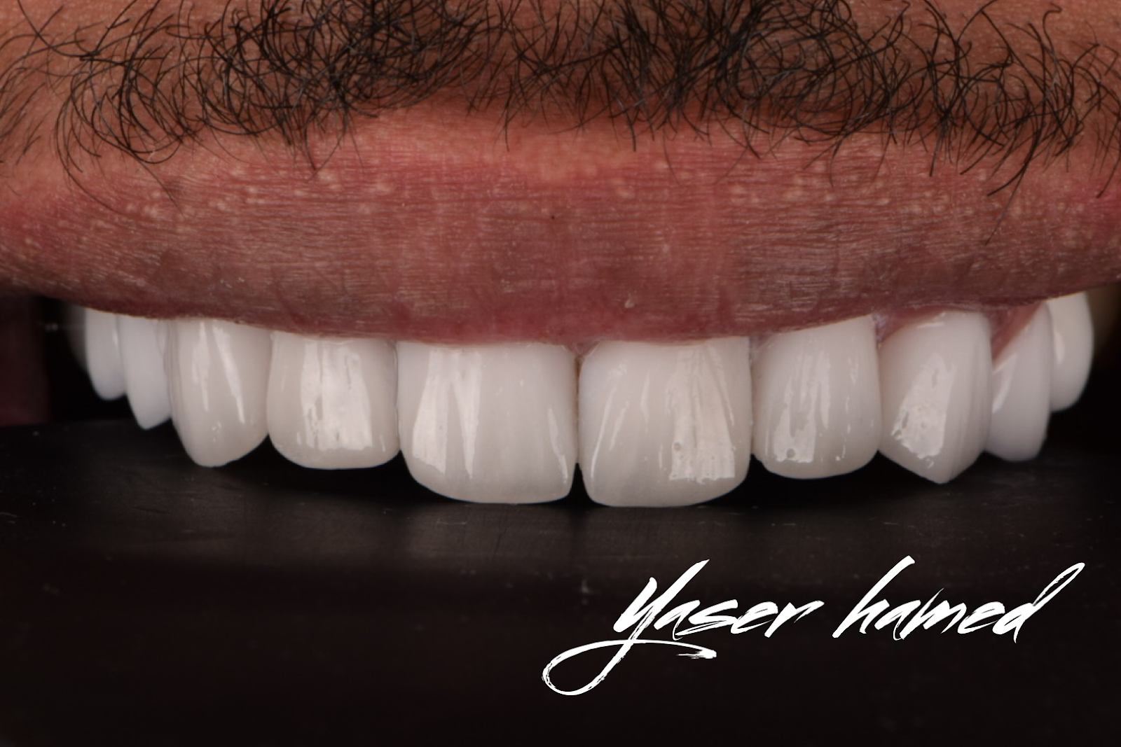 عيادات آســــــر لطب وتقويم الأسنان - صورة 3