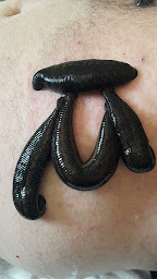 Photo n°20 de Marie-Rose Lechantoux Naturopathe Hirudothérapeute (Pose de sangsues médicinales) à Istres (Naturopathe)