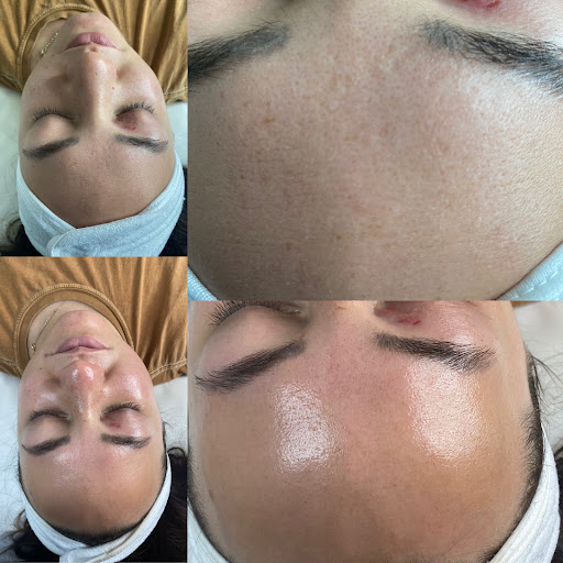 Ageless Glow Aesthetics - Thumbnail