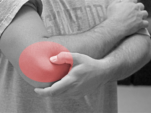 Physiotherapy Treatment for Tennis Elbow. post image