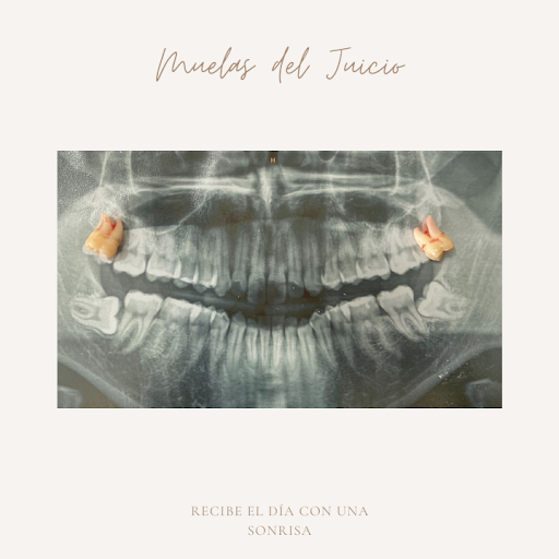 ARREOLA DENTAL - Thumbnail