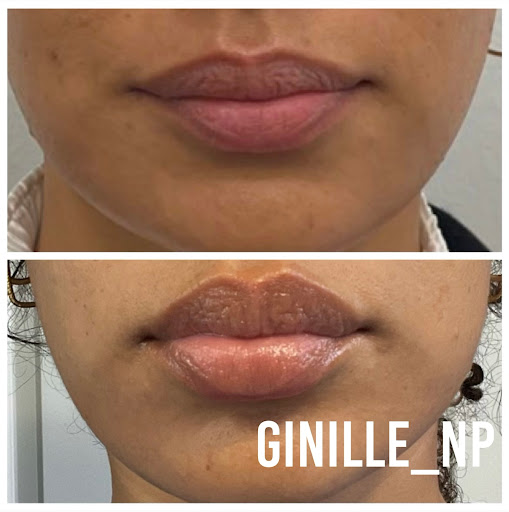 Ginille Beauty Aesthetics