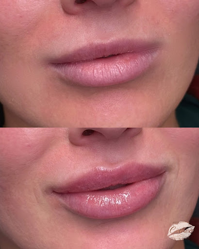 Cameo Facial Aesthetics