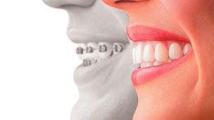 Photo n°1 de Dr COSTA Carla à Plonéour-Lanvern (Dentiste)