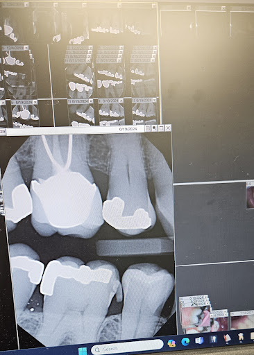 Chandler Dental Health Gallery - United States