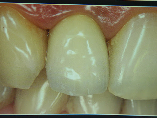 Dentistas Coatepec Especialistas Dentales - Thumbnail