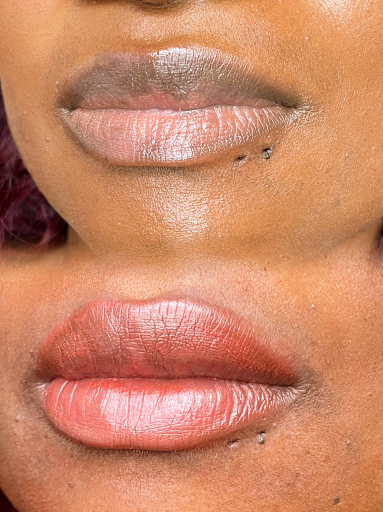 NOTO Permanent Aesthetics