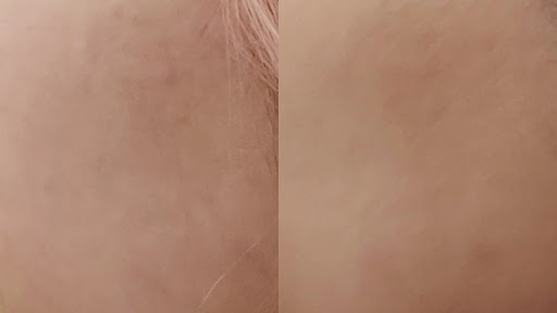 Ethereal Skin Aesthetics