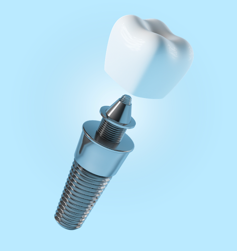 Smile Makers Group - Dr. Carlos Marquez - Thumbnail